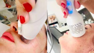 Innovatív rádiófrekvenciás arckezelés Dr. Fábiánné Erdődy Noémi kozmetikussal